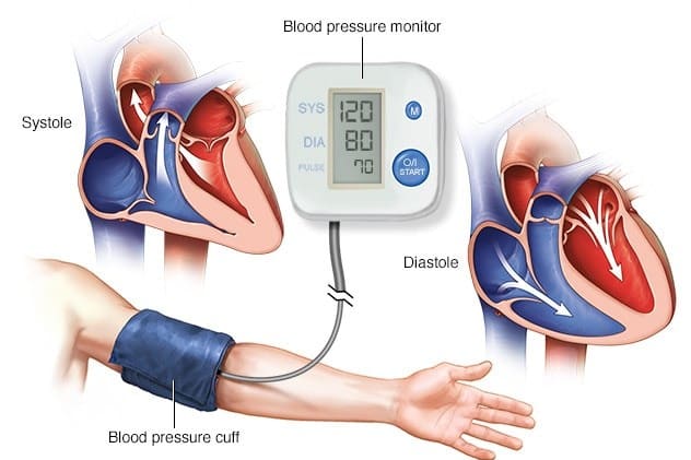 HYPERTENSION CHECKUP