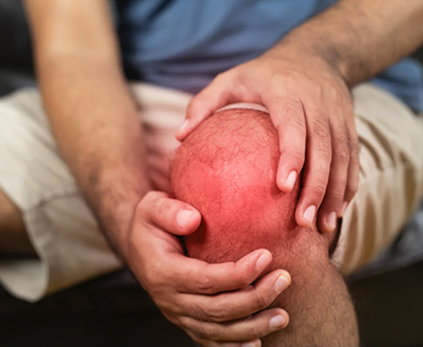 arthritis