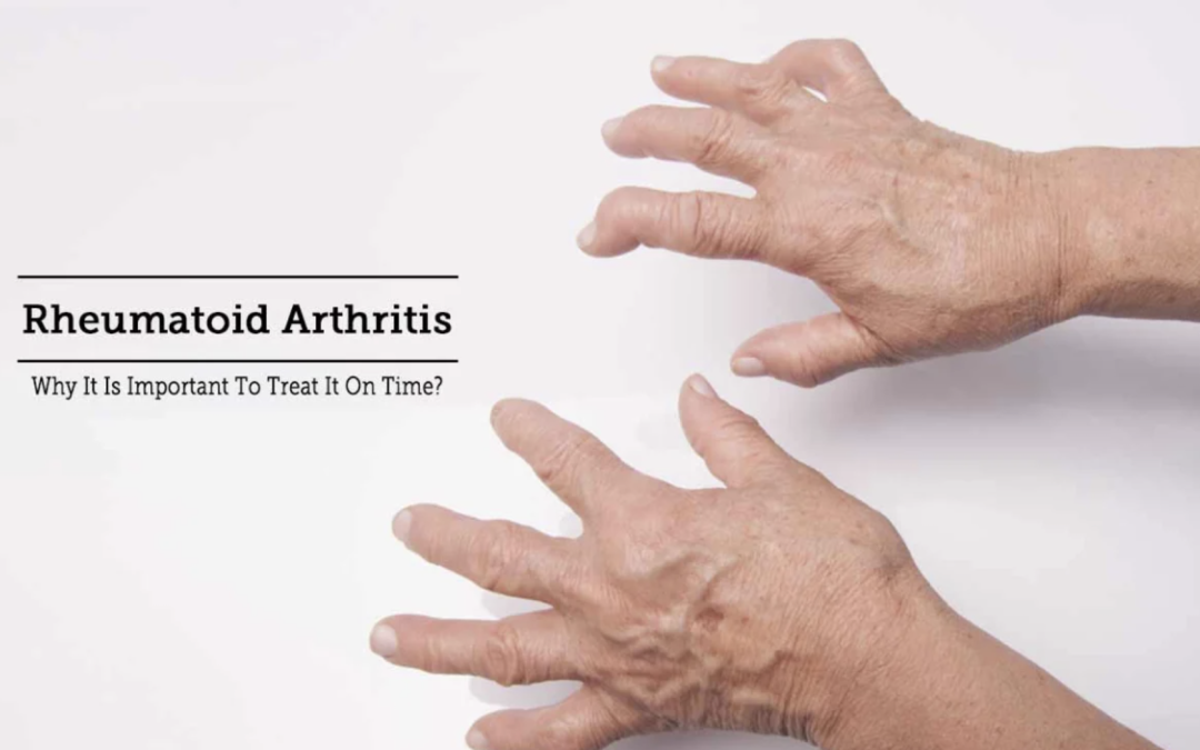 Rheumatoid Arthritis treatment - Dr. Debabrata Sarkar